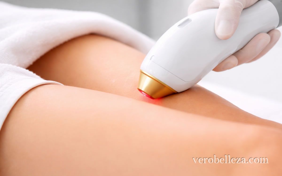 depilacion laser 1