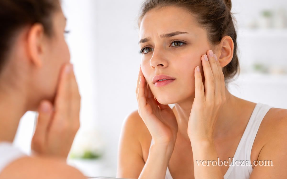 preocupada por el acne