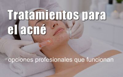 Tratamientos para el acné: opciones profesionales que funcionan